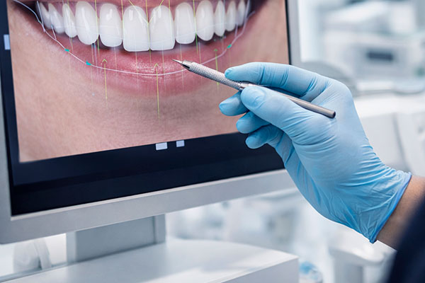 Diseño de sonrisa Palma Mallorca